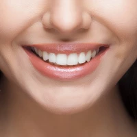 Teeth Implants 11