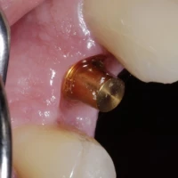 Dental Implant Specialists 11